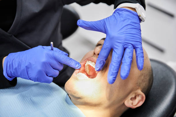 Best Emergency Dentist for Lost Fillings or Crowns in Pinedale, WY